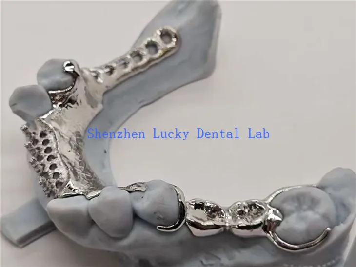 3D tiskani okvir z zasnovo zobnega zoba