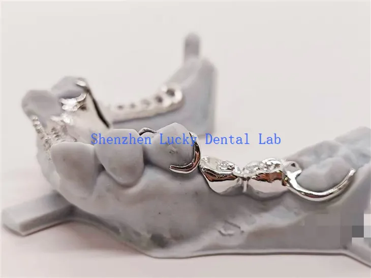 Kovinski okvir z zasnovo zobnega zoba